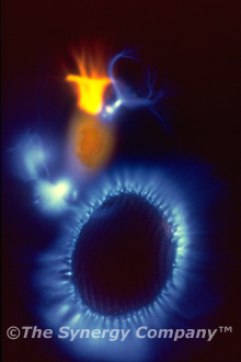 Kirlian Image